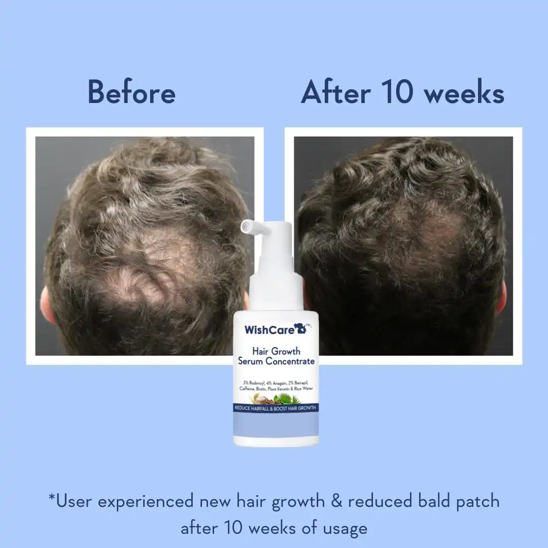 Product image of WishCare Hair Growth Serum Concentrate