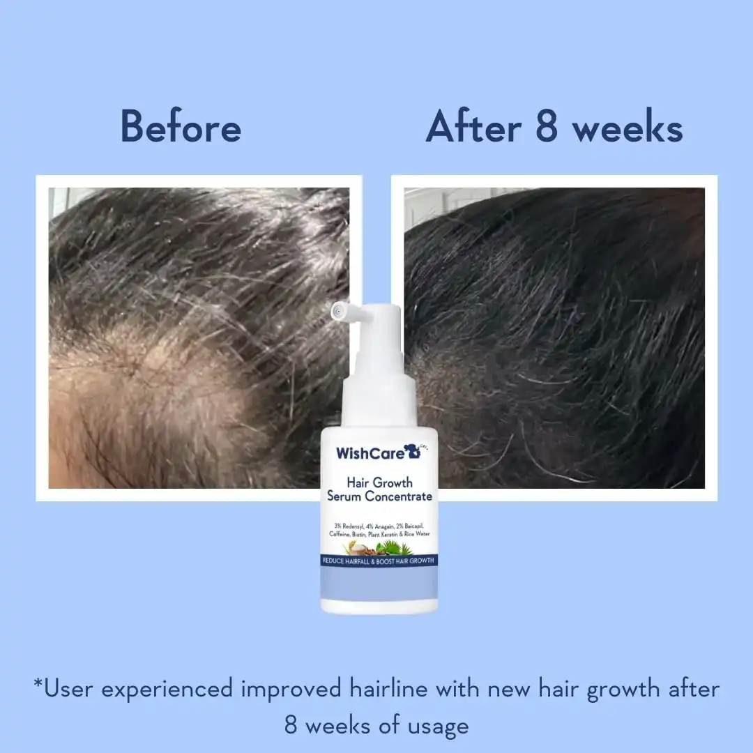 Product image of WishCare Hair Growth Serum Concentrate