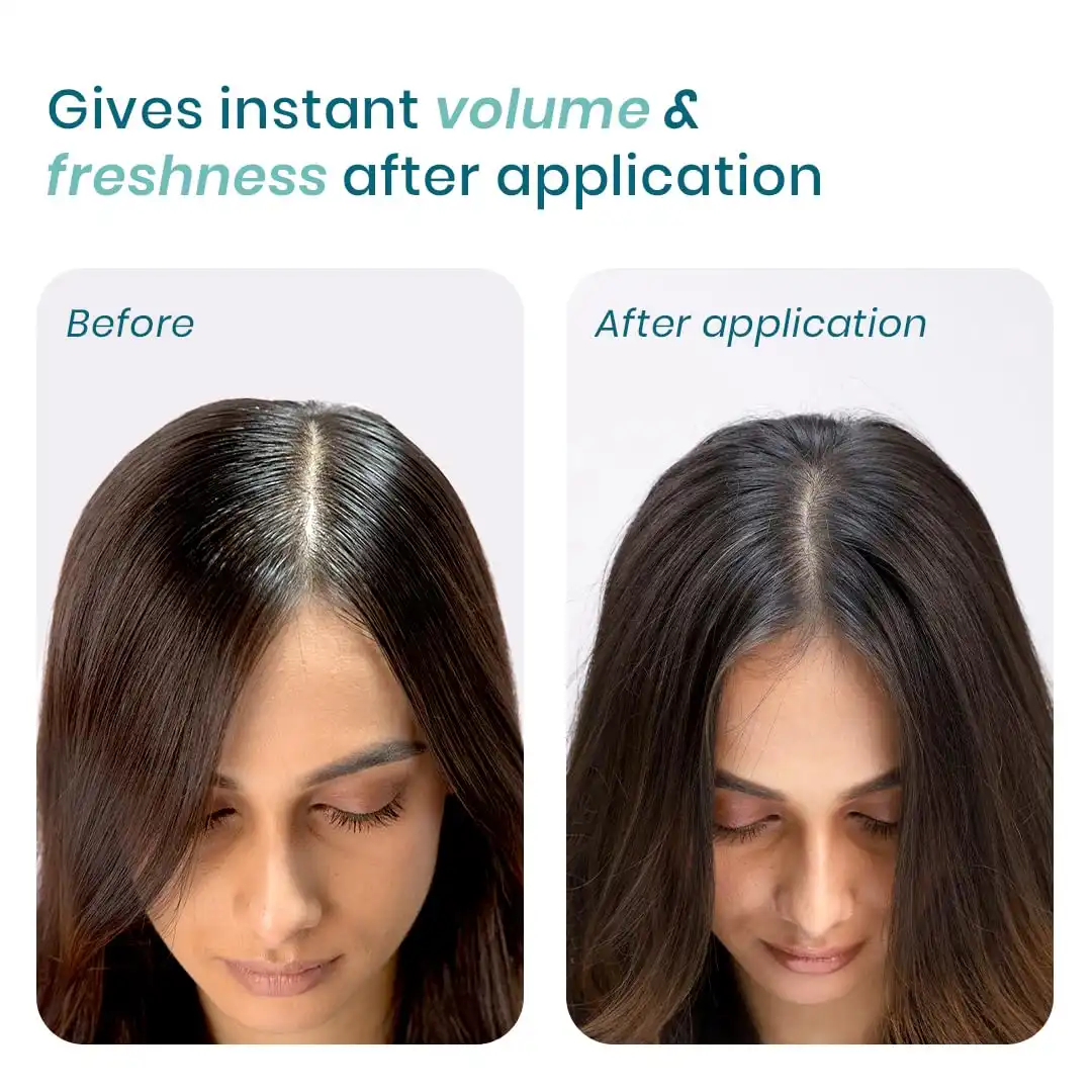 Product image of WishCare Air Powder Dry Shampoo | Absorbs Excess Oil and Adds Instant Volume to Hair | 10gm