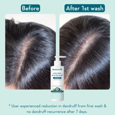 WishCare AHA BHA Anti-Dandruff ...