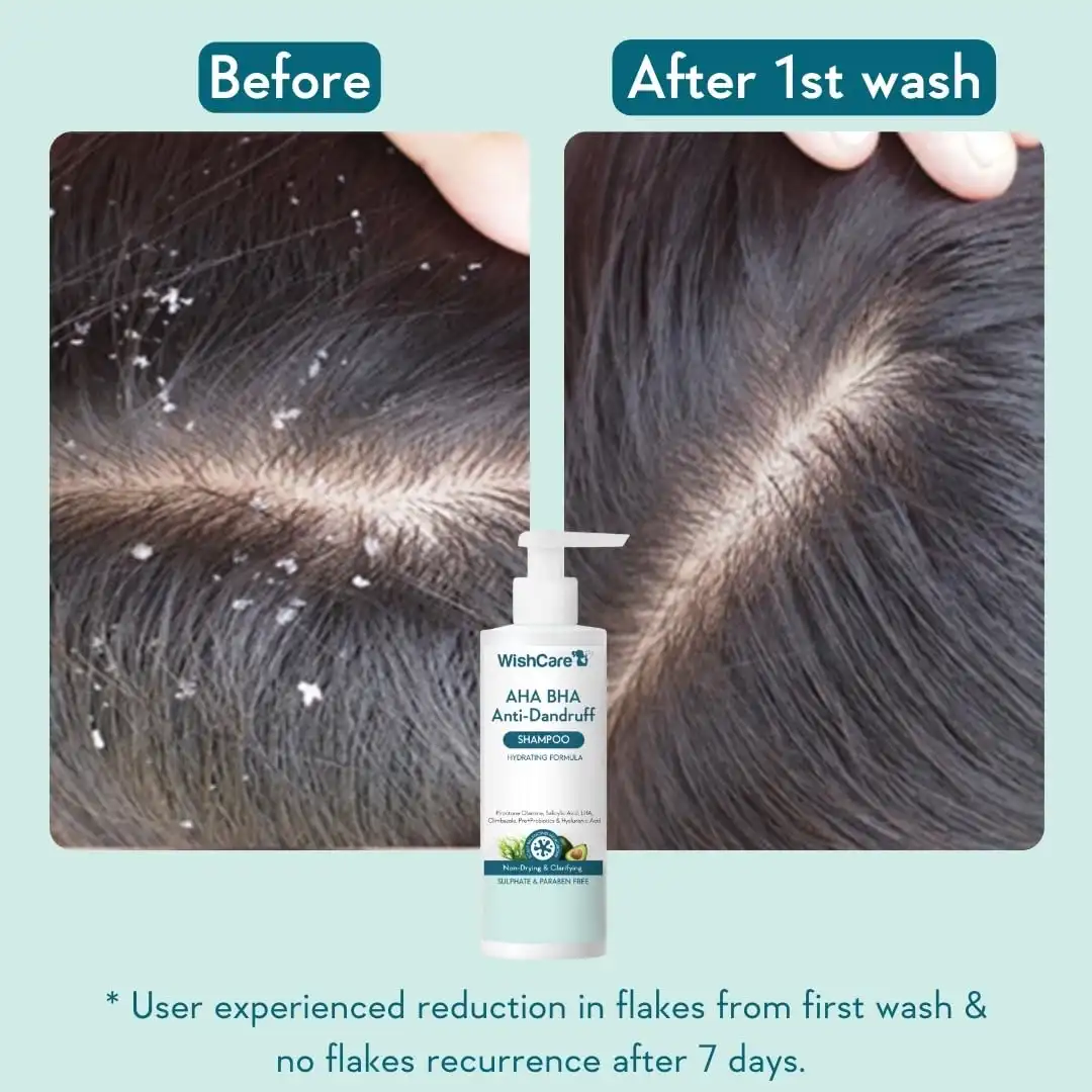 Product image of WishCare AHA BHA Anti-Dandruff Shampoo