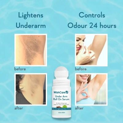 Wishcare Under Arm Roll On Seru...