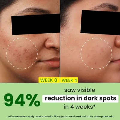 Dot & Key 10% Niacinamide + Cic...