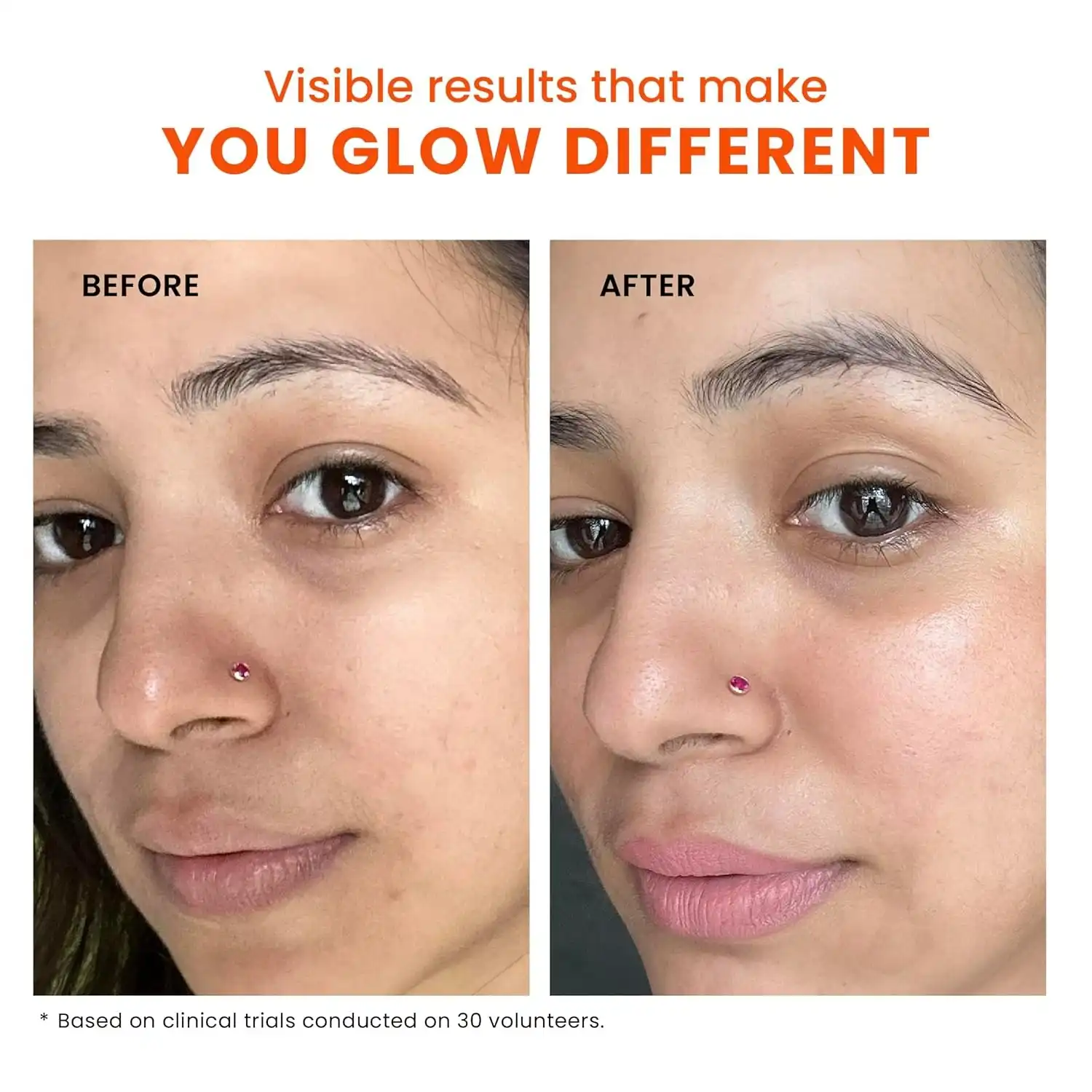 Product image of Foxtale De-Tan Face Mask for Glowing Skin| Clay Mask with Lactic Acid for Tan Removal, Reduction in Blackheads, Instant Brightening| New-Age Ubtan Face Pack for All Skin Types | Men & Women- 75g