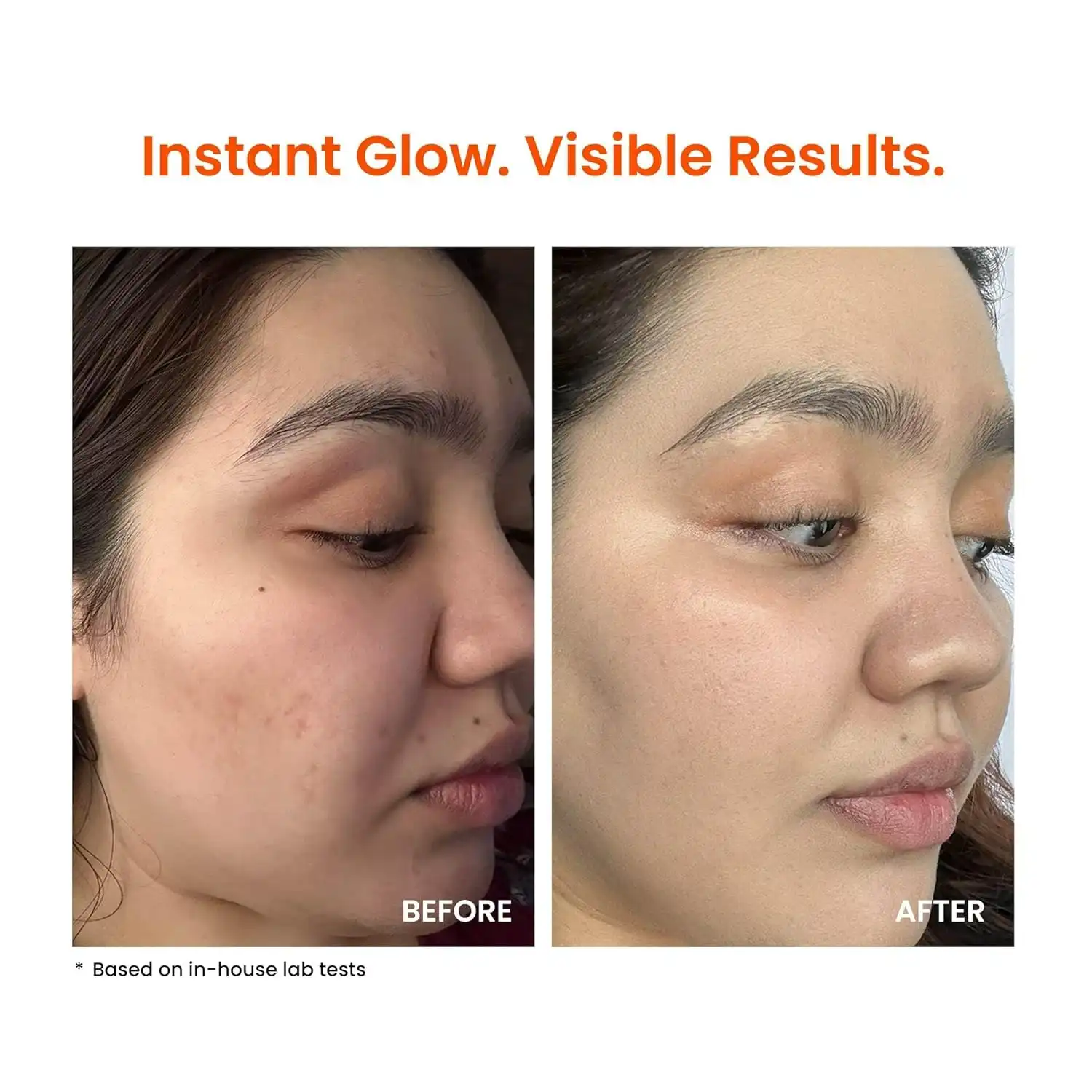 Product image of Foxtale Vitamin C Super Glow Moisturizer with Niacinamide & Peptides, Visibly Reduces Pigmentation, Enhances Skins Brightness Instantly, For All Skin Types, Women & Men - 50ml, Cream