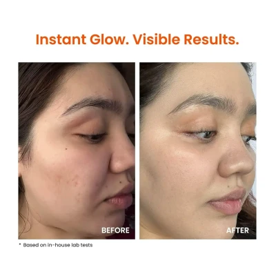 Foxtale Vitamin C Super Glow Mo...