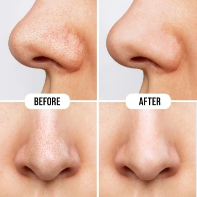 Hilary Rhoda Deep Cleanse Nose ...