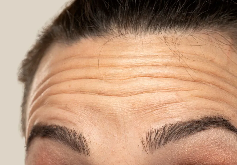 Anti Ageing