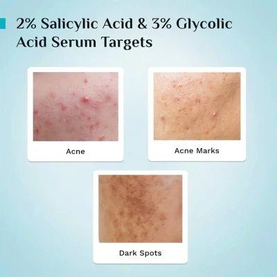 Pilgrim Face Serum | 2% Salicyl...