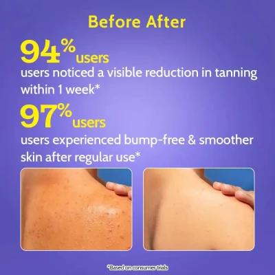 Chemist At Play | Exfoliating B...