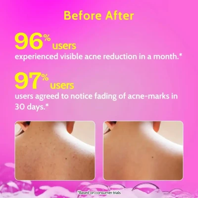 Chemist At play |  1% Salicylic...